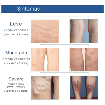 PARCHES PARA VARICES